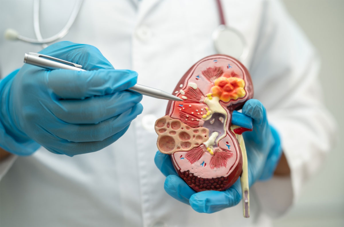Kidney-Disease